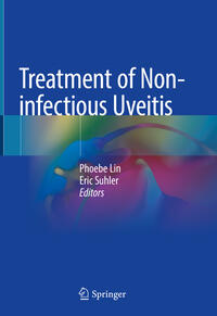 Vorderes Coverbild Treatment of Non-infectious Uveitis