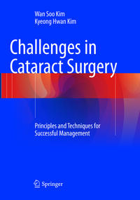 Vorderes Coverbild Challenges in Cataract Surgery