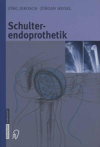 Vorderes Coverbild Schulterendoprothetik