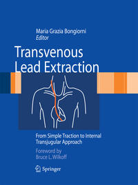 Vorderes Coverbild Transvenous Lead Extraction