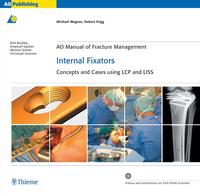 Vorderes Coverbild AO Manual of Fracture Management: Internal Fixators