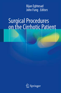 Vorderes Coverbild Surgical Procedures on the Cirrhotic Patient