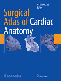 Vorderes Coverbild Surgical Atlas of Cardiac Anatomy