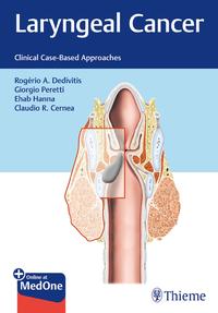 Vorderes Coverbild Laryngeal Cancer