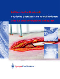 Vorderes Coverbild Septische postoperative Komplikationen