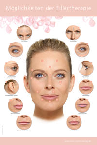 Vorderes Coverbild Poster – Möglichkeiten der Fillertherapie