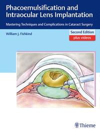 Vorderes Coverbild Phacoemulsification and Intraocular Lens Implantation
