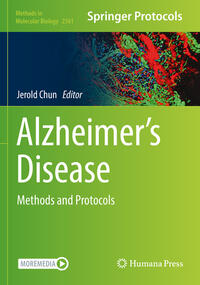 Vorderes Coverbild Alzheimer’s Disease