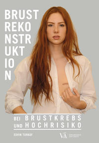 Vorderes Coverbild Brustrekonstruktion