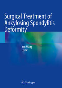 Vorderes Coverbild Surgical Treatment of Ankylosing Spondylitis Deformity