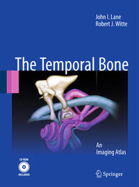 Vorderes Coverbild Temporal Bone