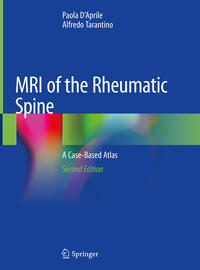 Vorderes Coverbild MRI of the Rheumatic Spine