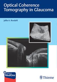 Vorderes Coverbild Optical Coherence Tomography in Glaucoma