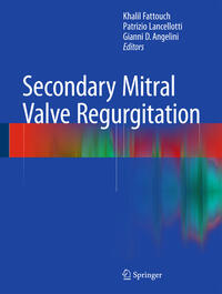 Vorderes Coverbild Secondary Mitral Valve Regurgitation