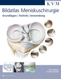 Vorderes Coverbild Bildatlas Meniskuschirurgie