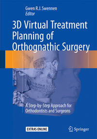 Vorderes Coverbild 3D Virtual Treatment Planning of Orthognathic Surgery