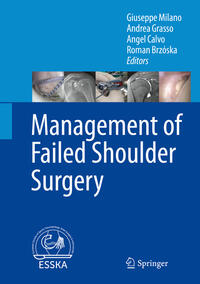 Vorderes Coverbild Management of Failed Shoulder Surgery