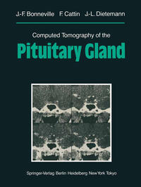 Vorderes Coverbild Computed Tomography of the Pituitary Gland