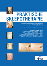 Vorderes Coverbild Praktische Sklerotherapie