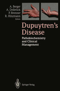 Vorderes Coverbild Dupuytren’s Disease