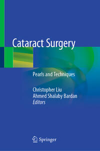 Vorderes Coverbild Cataract Surgery