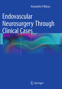 Vorderes Coverbild Endovascular Neurosurgery Through Clinical Cases