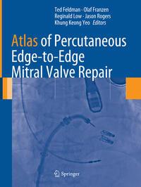 Vorderes Coverbild Atlas of Percutaneous Edge-to-Edge Mitral Valve Repair