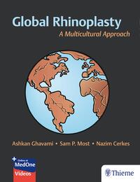 Vorderes Coverbild Global Rhinoplasty