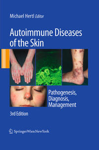 Vorderes Coverbild Autoimmune Diseases of the Skin
