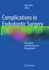 Vorderes Coverbild Complications in Endodontic Surgery