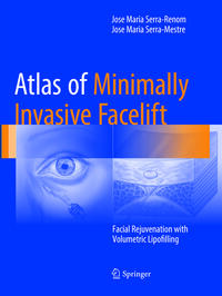 Vorderes Coverbild Atlas of Minimally Invasive Facelift