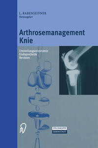 Vorderes Coverbild Arthrosemanagement Knie
