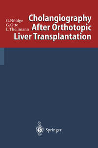 Vorderes Coverbild Cholangiography After Orthotopic Liver Transplantation
