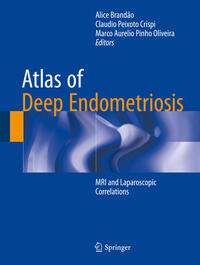 Vorderes Coverbild Atlas of Deep Endometriosis