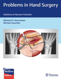 Vorderes Coverbild Problems in Hand Surgery