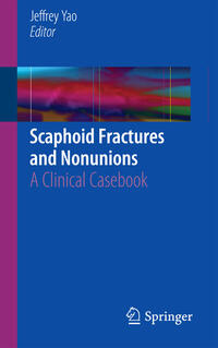 Vorderes Coverbild Scaphoid Fractures and Nonunions