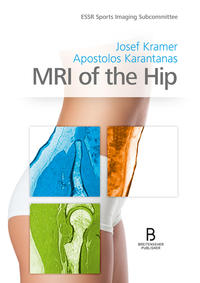 Vorderes Coverbild MRI of the Hip