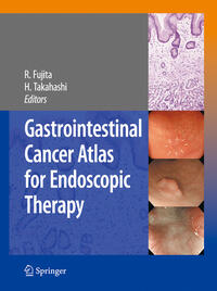 Vorderes Coverbild Gastrointestinal Cancer Atlas for Endoscopic Therapy
