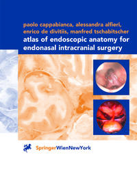Vorderes Coverbild Atlas of Endoscopic Anatomy for Endonasal Intracranial Surgery
