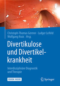 Vorderes Coverbild Divertikulose und Divertikelkrankheit