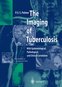 Vorderes Coverbild The Imaging of Tuberculosis