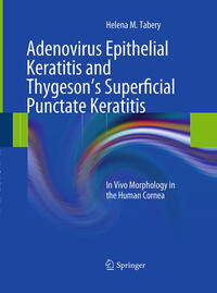 Vorderes Coverbild Adenovirus Epithelial Keratitis and Thygeson's Superficial Punctate Keratitis