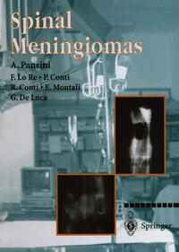 Vorderes Coverbild Spinal Meningiomas