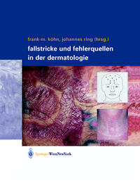Vorderes Coverbild Fallstricke und Fehlerquellen in der Dermatologie