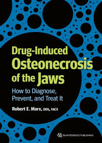 Vorderes Coverbild Drug-Induced Osteonecrosis of the Jaws