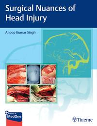 Vorderes Coverbild Surgical Nuances of Head Injury