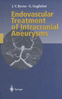 Vorderes Coverbild Endovascular Treatment of Intracranial Aneurysms