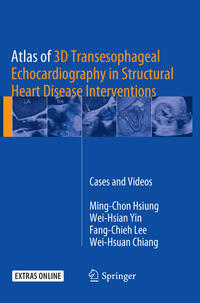 Vorderes Coverbild Atlas of 3D Transesophageal Echocardiography in Structural Heart Disease Interventions