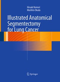 Vorderes Coverbild Illustrated Anatomical Segmentectomy for Lung Cancer