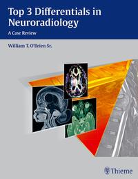 Vorderes Coverbild Top 3 Differentials in Neuroradiology